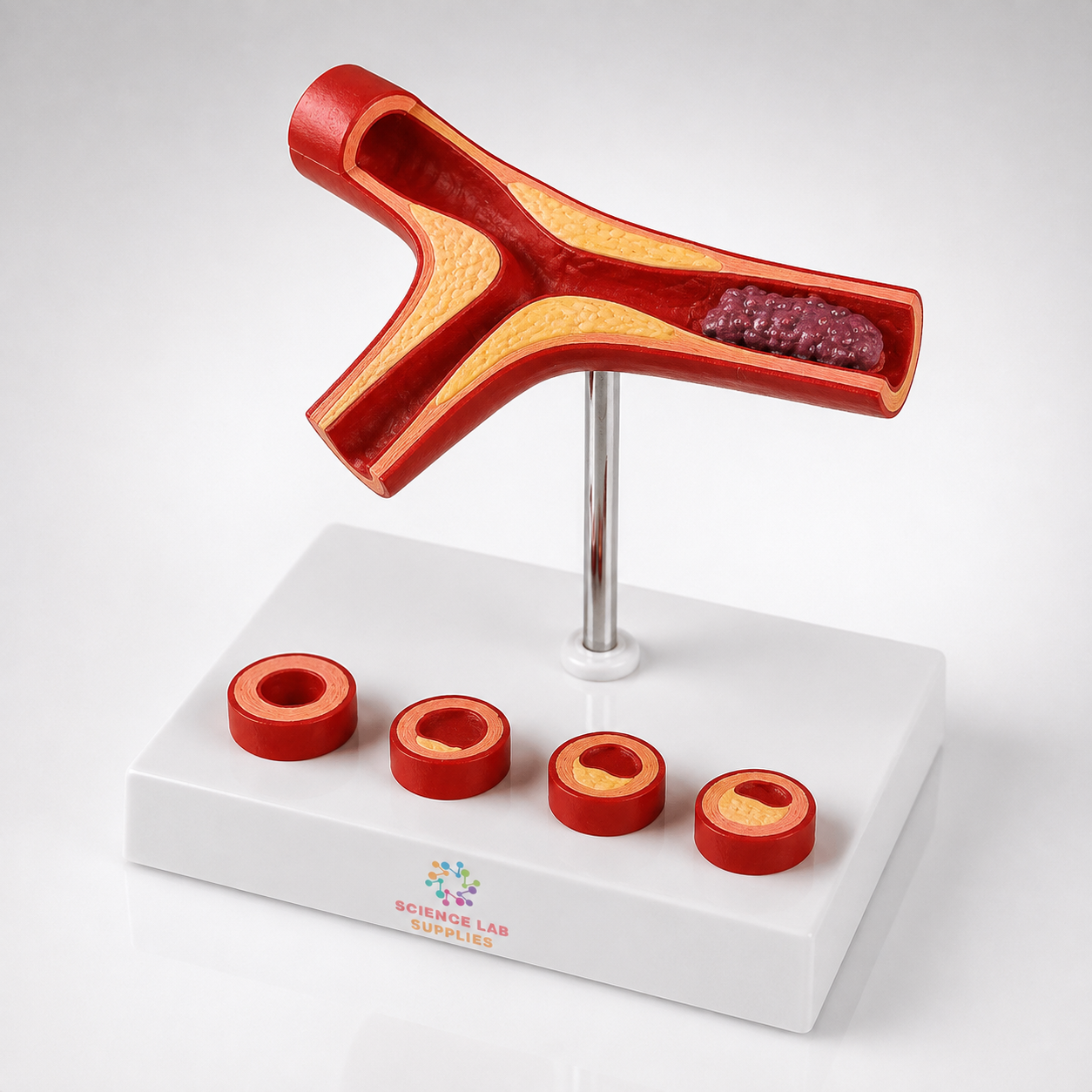 Atherosclerosis and Thrombosis Model