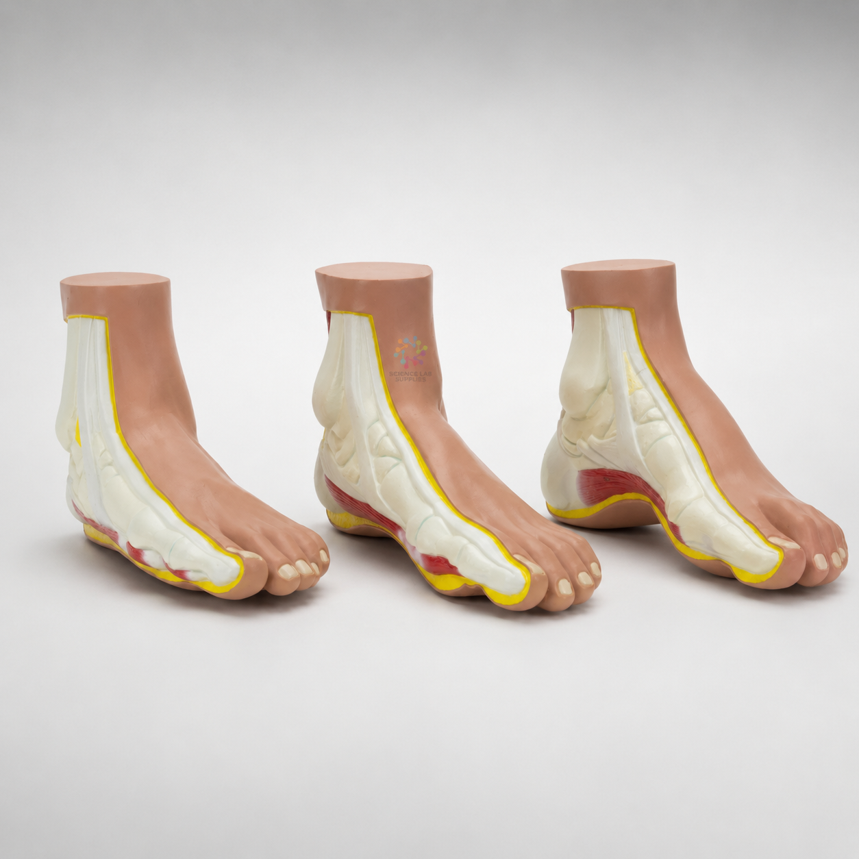 Normal and Abnormal Feet Model