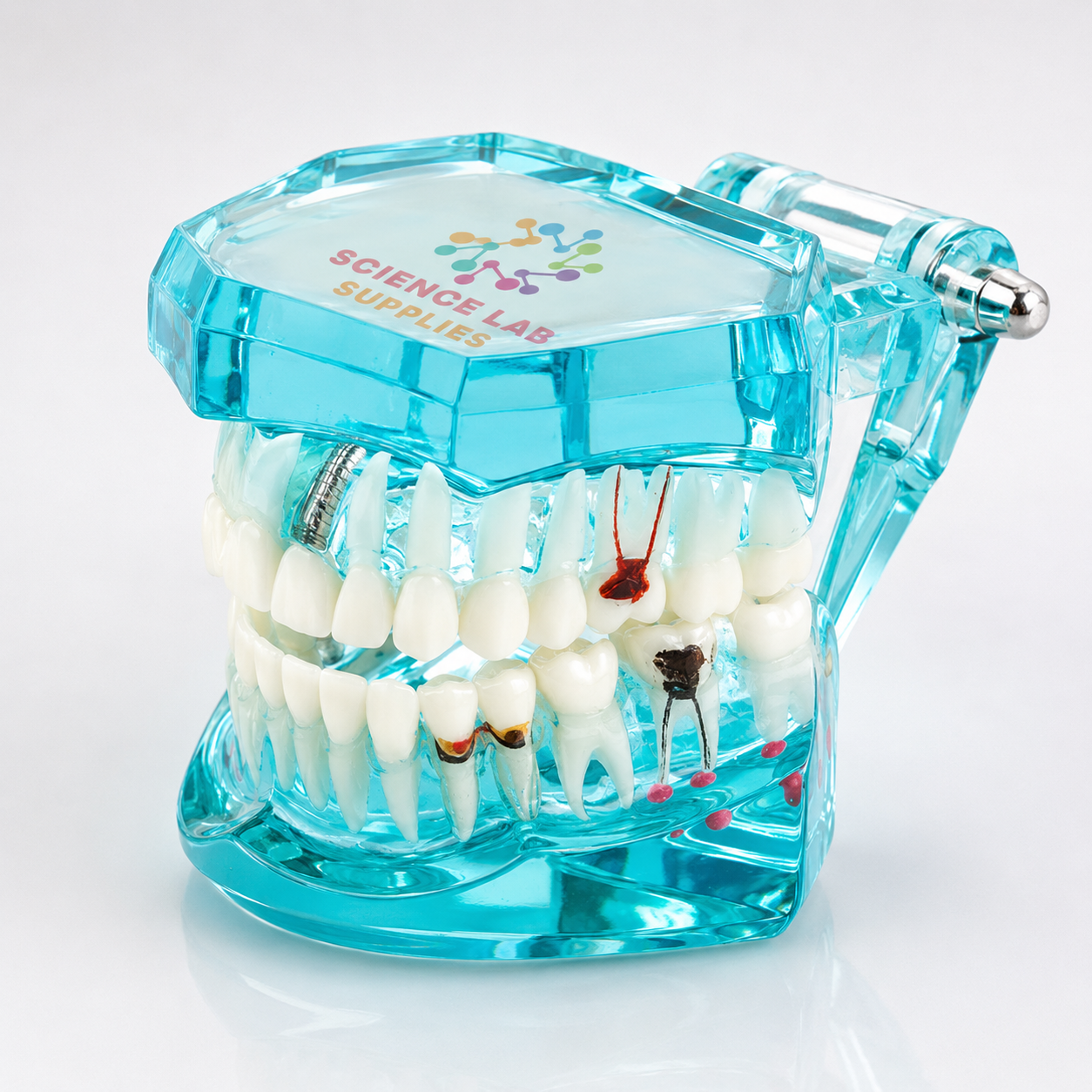Dental Pathology Model