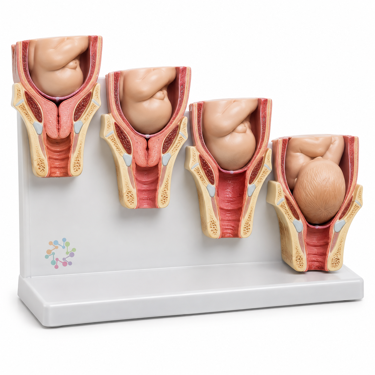 Antepartum Cervix Change and Birth Canal Relationship Model